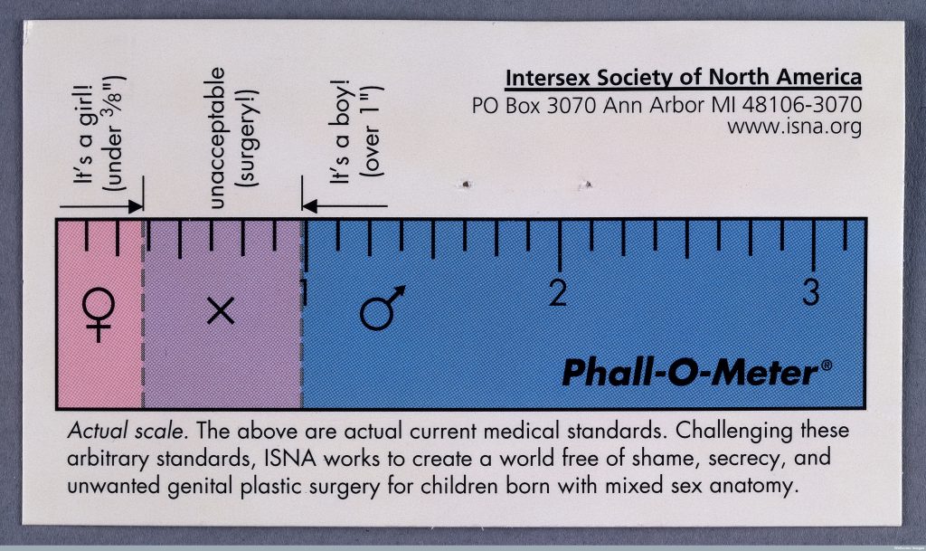 Ruler Used to Determine the Sex of Intersex Child